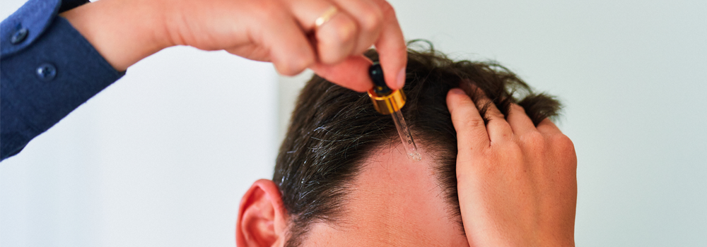 Cropped photo of a man with white skin and short brown hair applying a hair serum to the scalp.