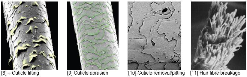 顕微鏡拡大図（図8-11）