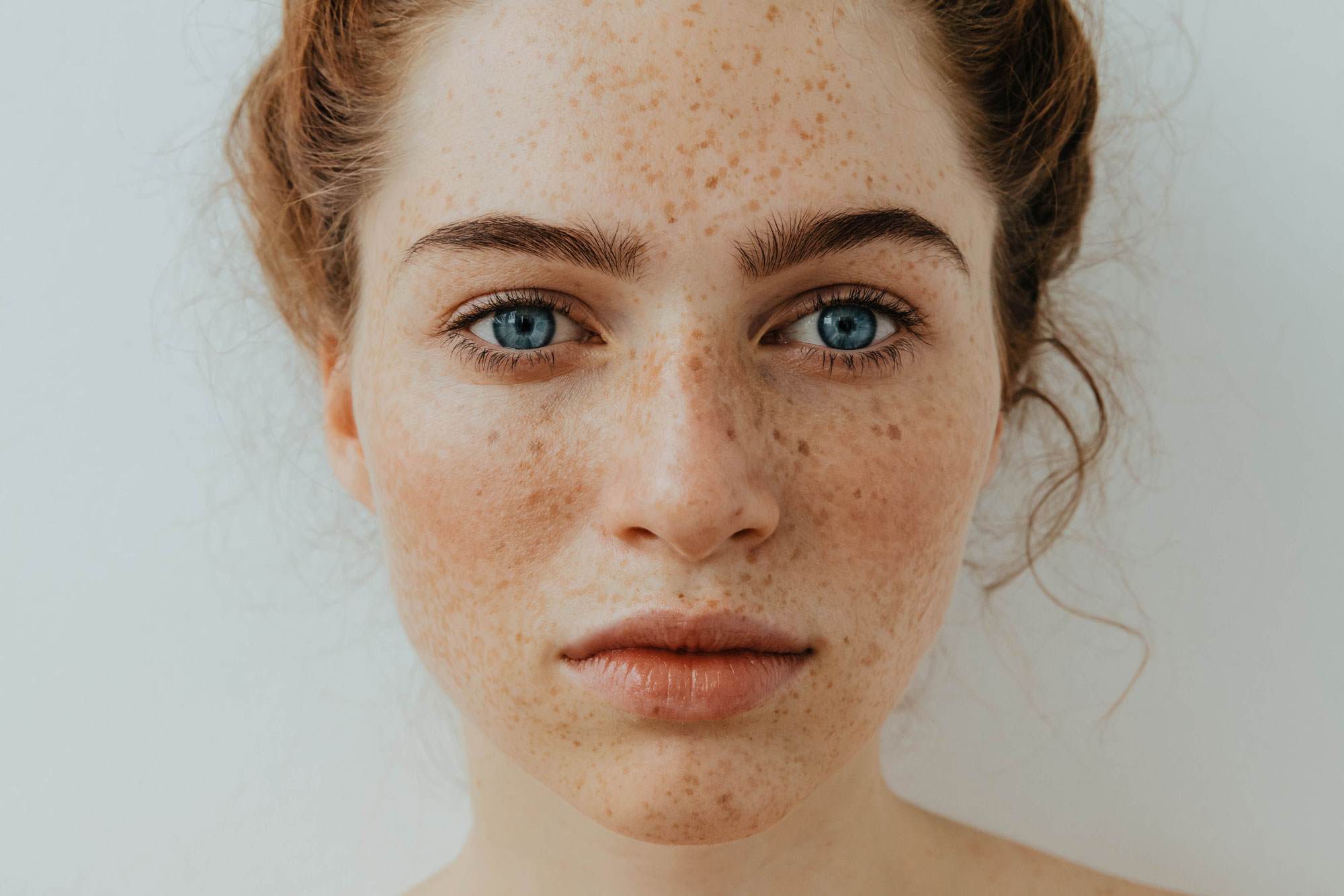 Young women's face with freckles