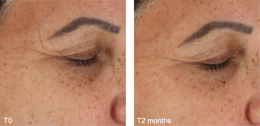 RevitalideBeforeAfter