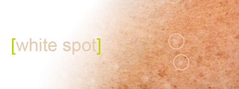 image of white and dark spots on white skin