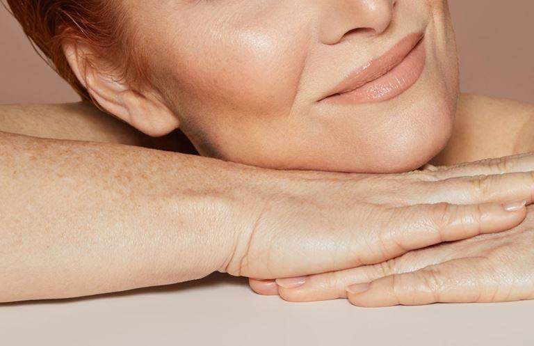 Middle aged white woman resting her face on her hands. The image is cropped so we can only see her lower face, which is smiling.