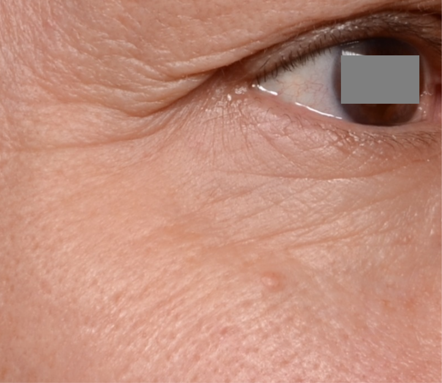 Before applyin Majestem Drypure on eye