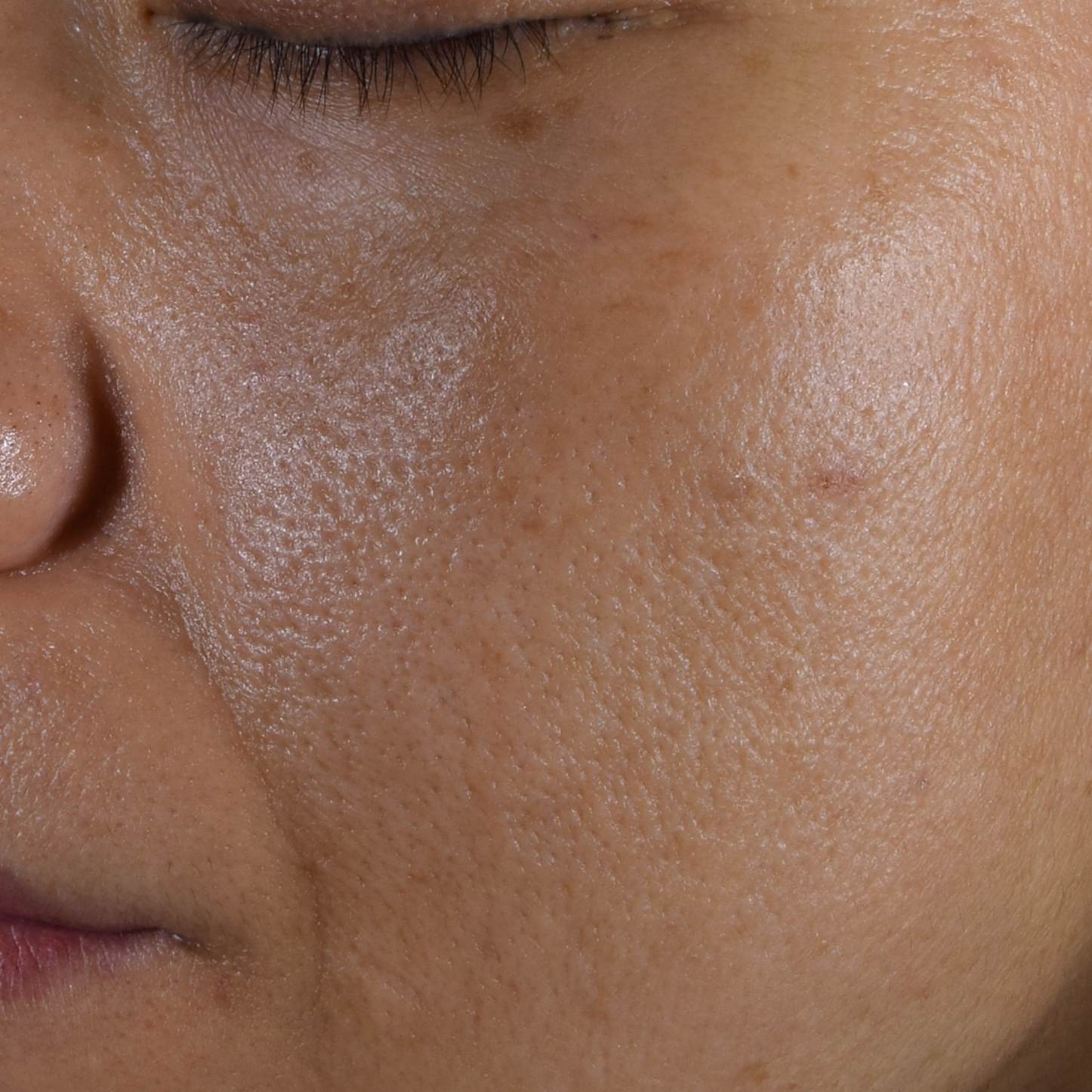 ポアテクト塗布前の左頬