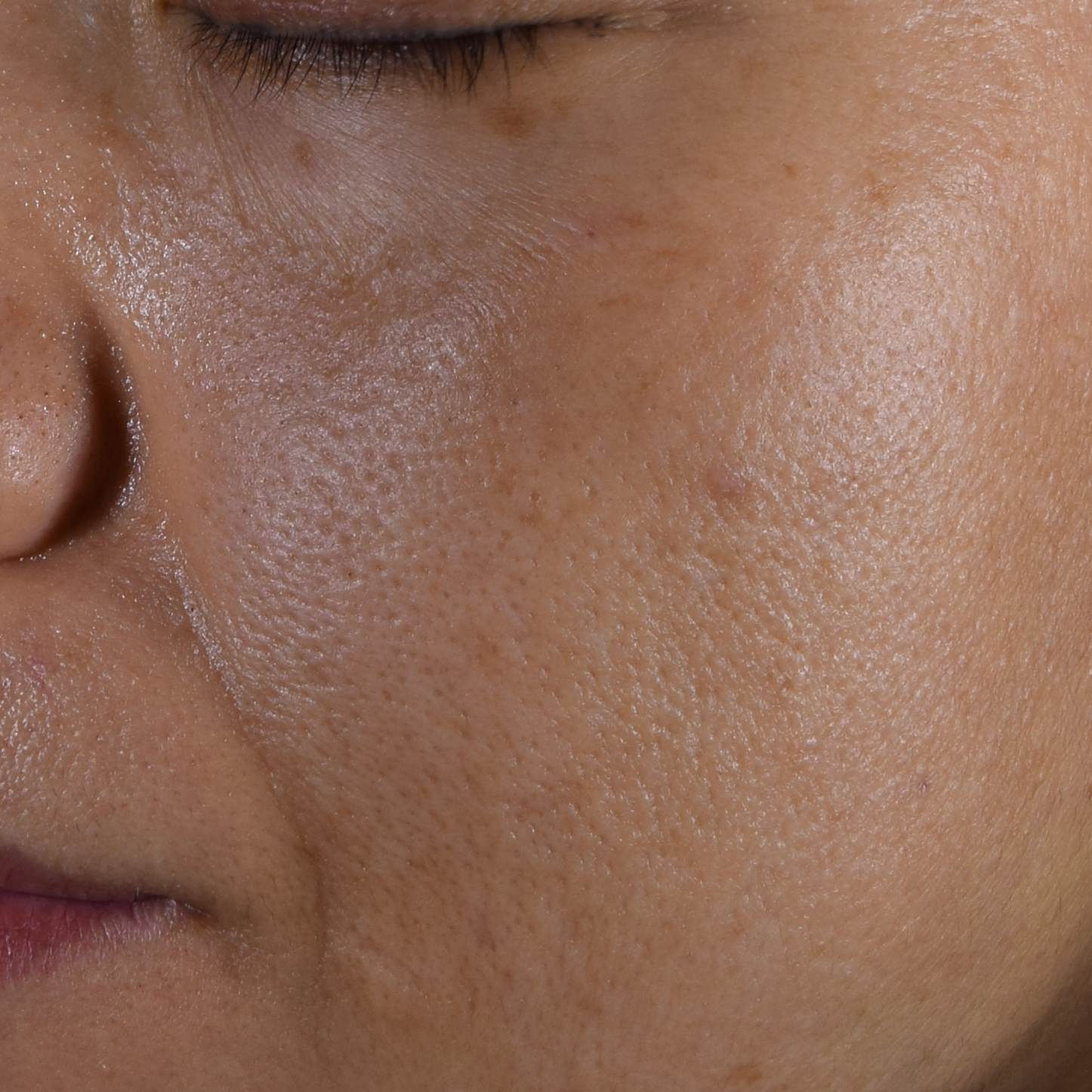 ポアテクト塗布後の左頬