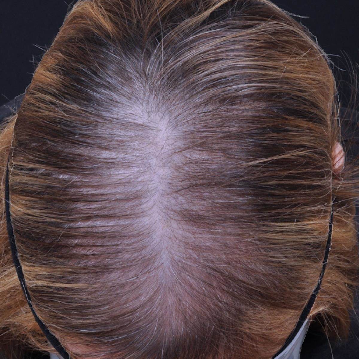 Procapil™ | Croda Beauty