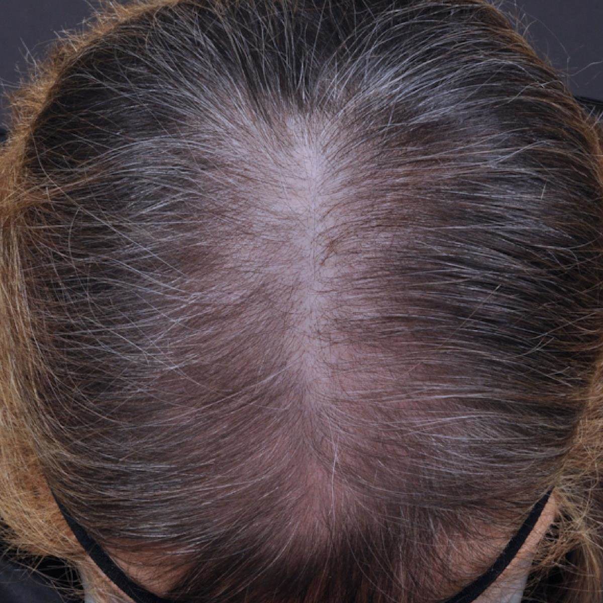 Procapil™ | Croda Beauty