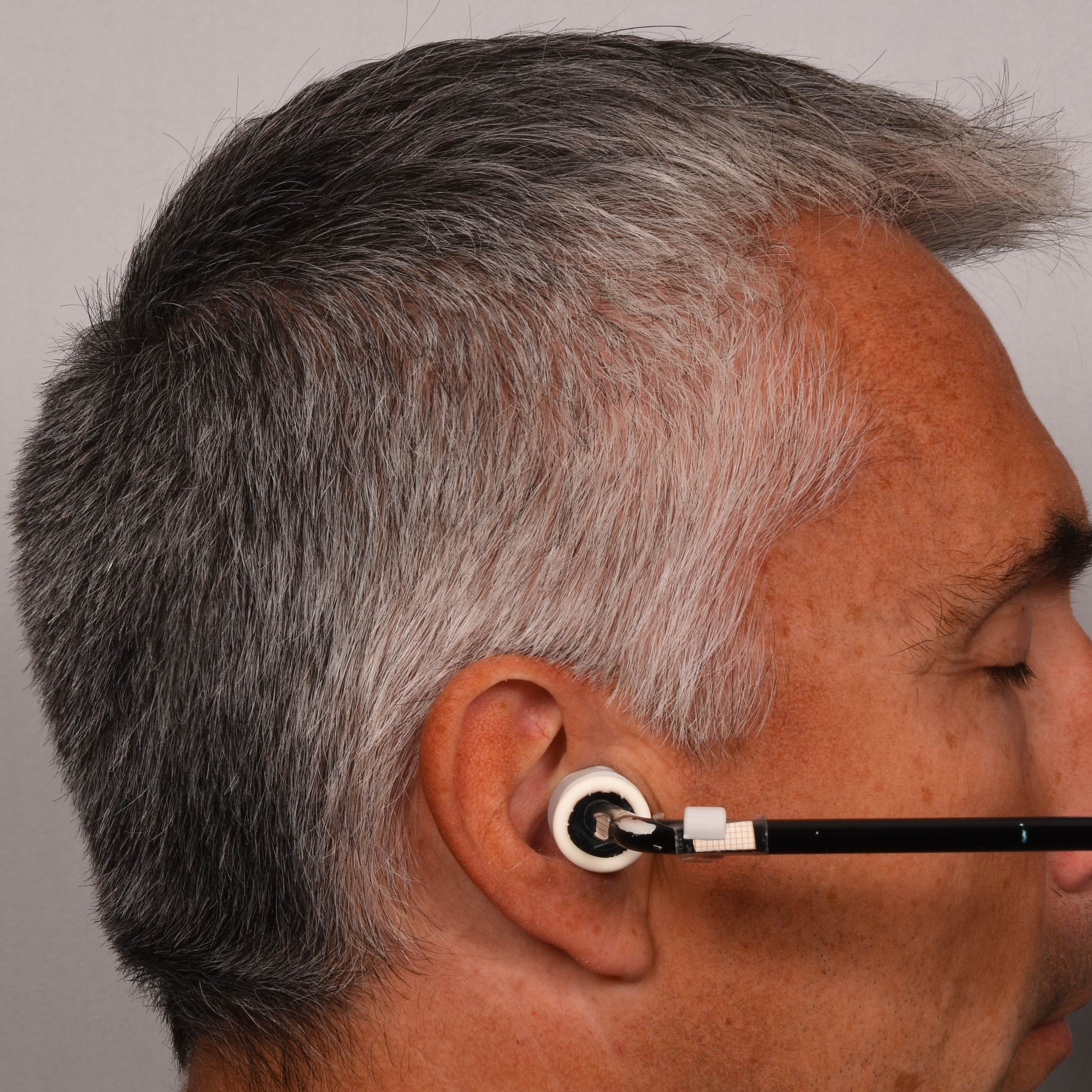  hair melanisation before applying SILVERFREE™ picture 2