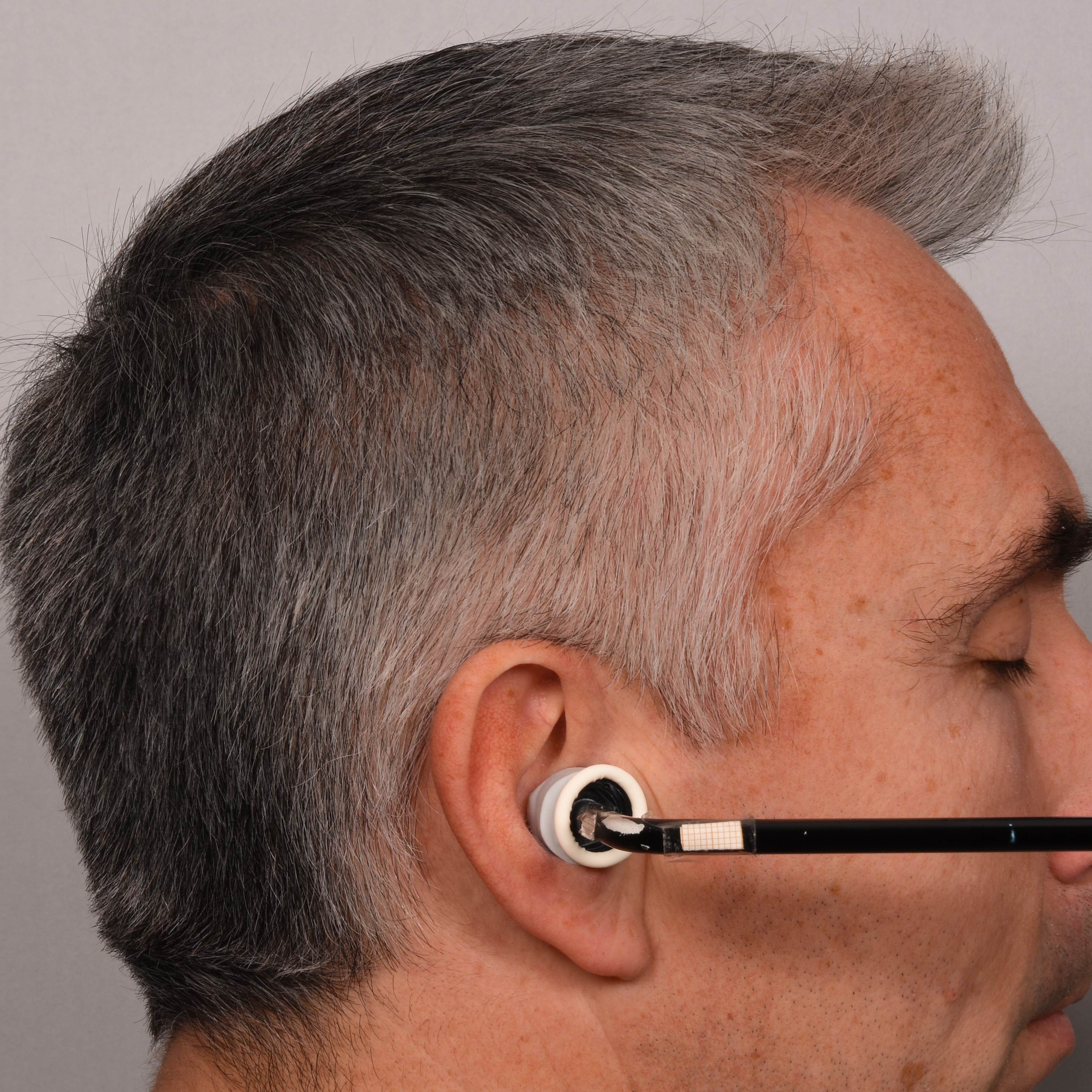  hair melanisation after applying SILVERFREE™ picture 2