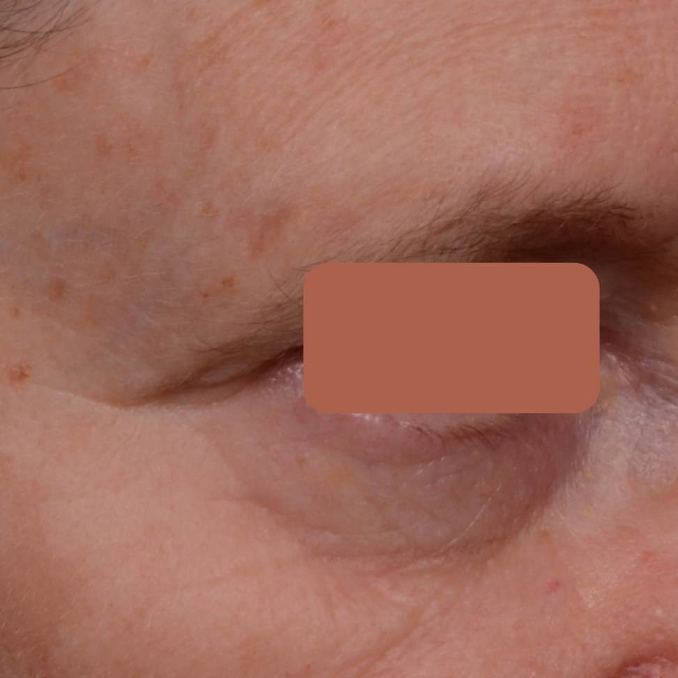 AFTER 8 WEEKS APPLYING SYNCHROLIFE™ eq.2 %