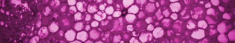 Close up on animal cells which have been coloured magenta.