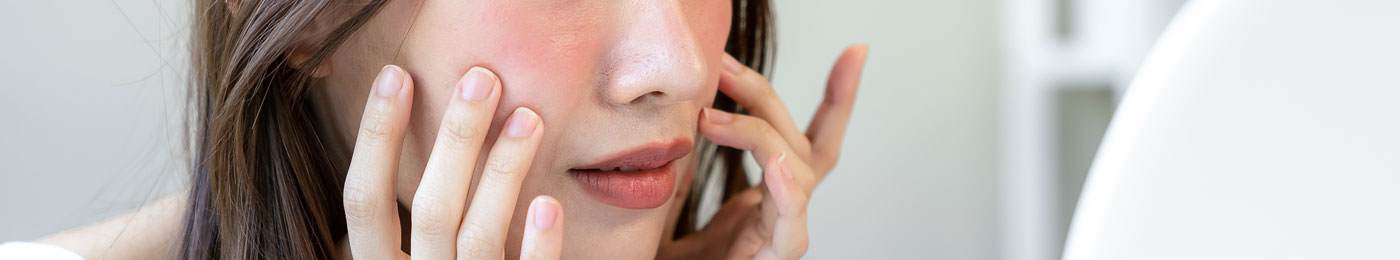 Cropped image of the face and hands of a young east asian woman touching her face. She has bright red cheeks.