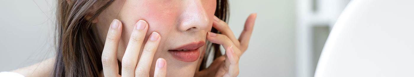 Cropped image of the face and hands of a young east asian woman touching her face. She has bright red cheeks.