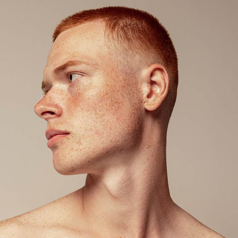 White man with red hair and freckles looking off the side.
